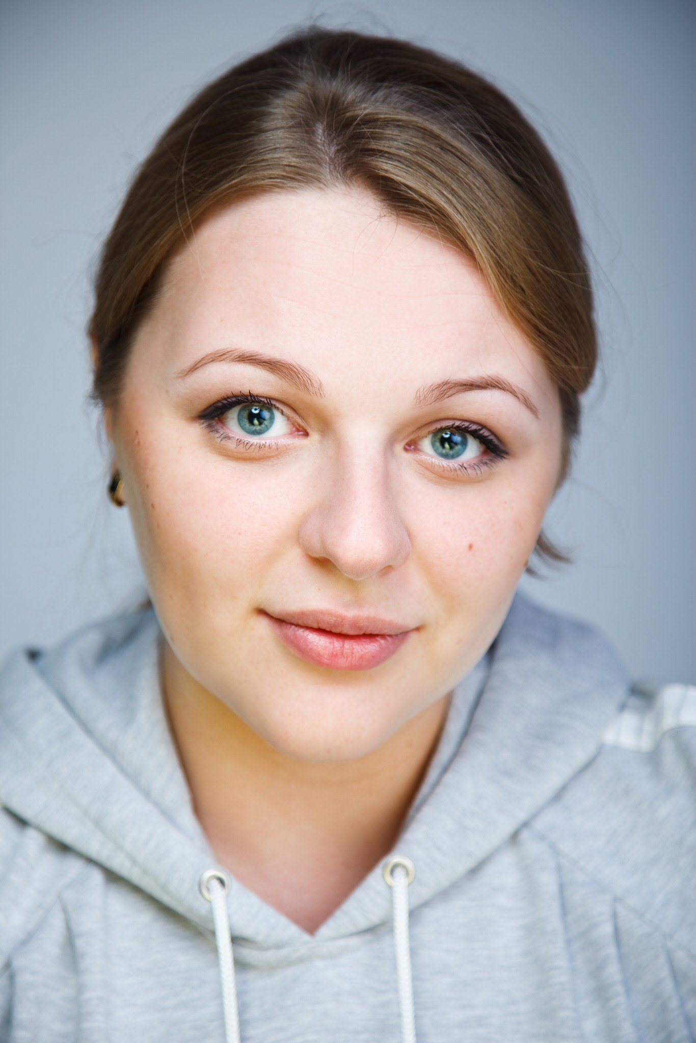 Личный опыт пациентки после ФРК на немецком лазере SCHWIND Amaris.