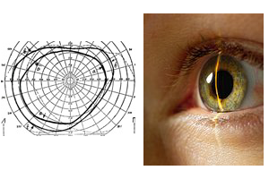 лечение глаукома